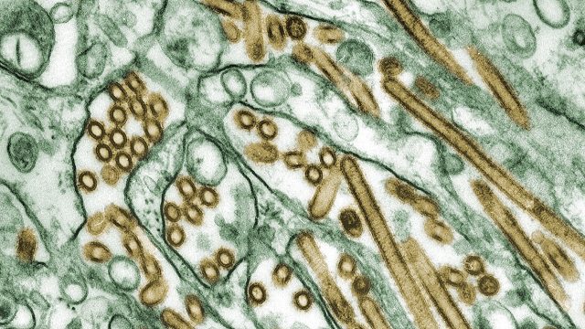 uma imagem de microscópio mostrando vírus H5N1 espalhados entre as células