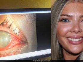 US Woman, 23, Goes Blind In One Eye After Swimming With Contact Lenses